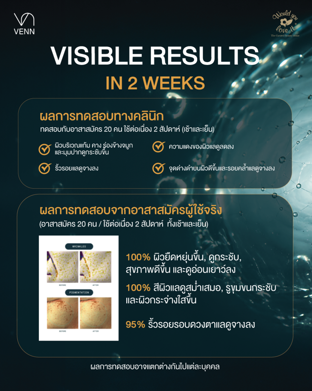 /storage/gallery/product/312/5.1)MULTI-PHOTO_ภาพที่4_1040x1300(1).png