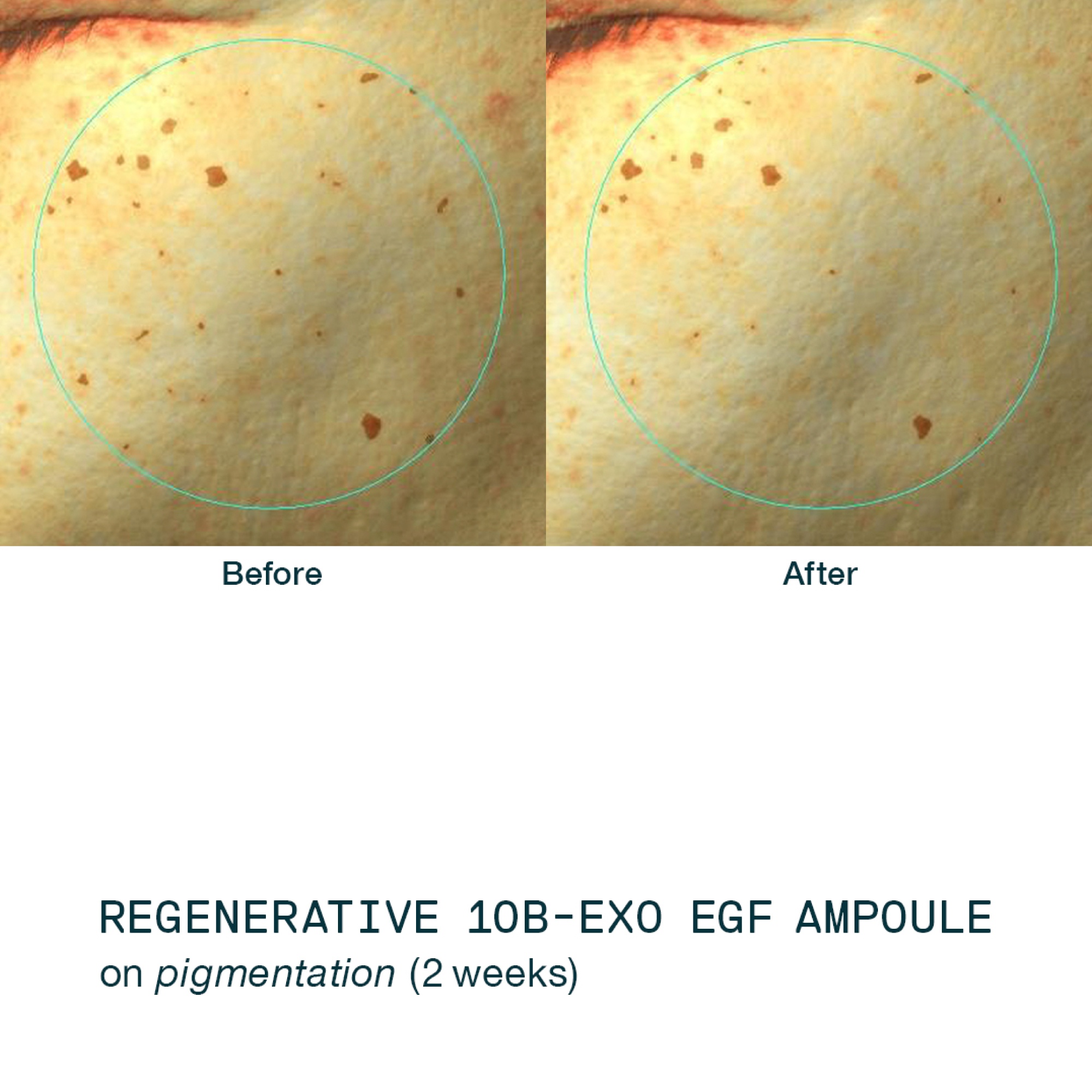 /storage/gallery/product/45/1.Regenerative-Serum-5.jpg